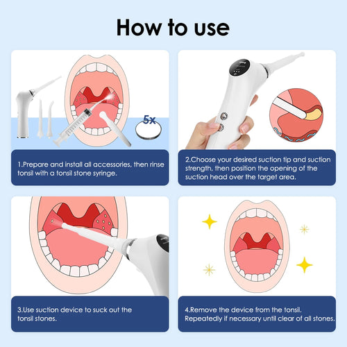 Pilore Electric Tonsil Stone Remover Tool