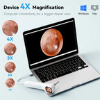 5-in-1 Smart Detector with Screen 1080P HD Ear Camera