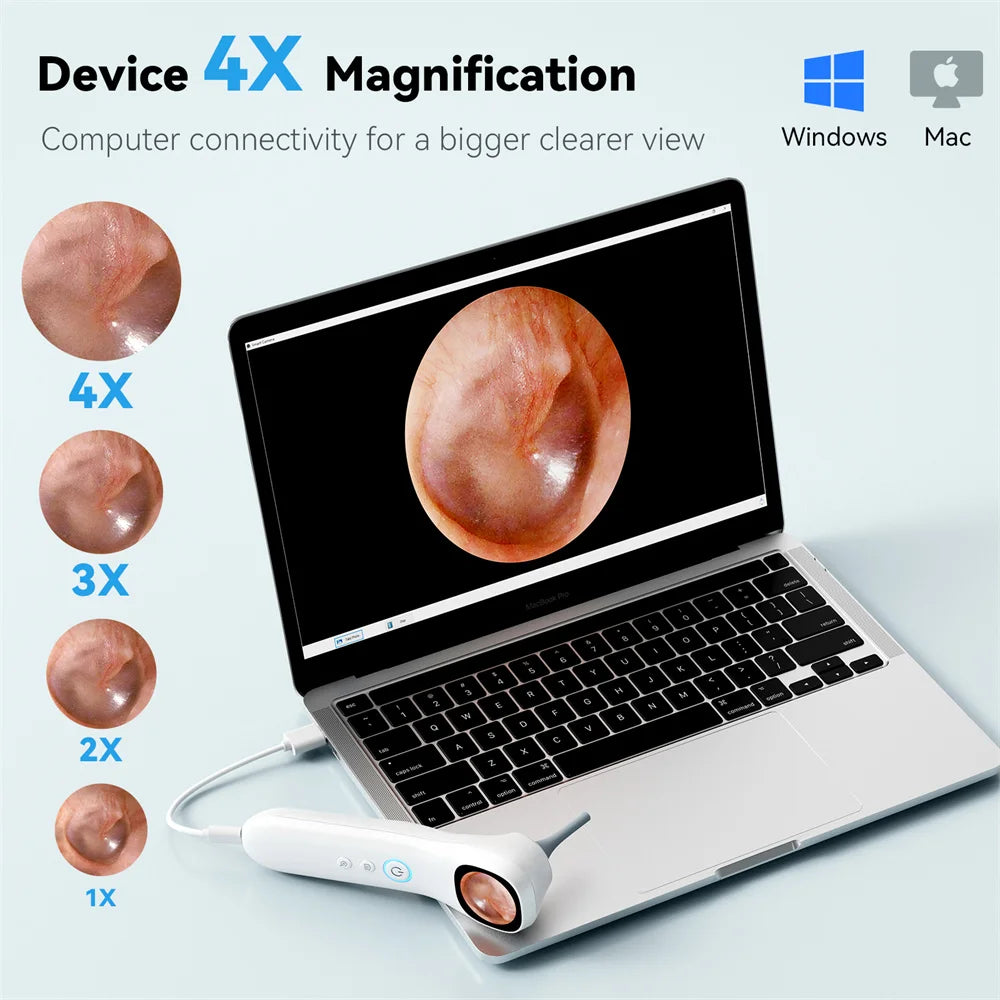 5-in-1 Smart Detector with Screen 1080P HD Ear Camera