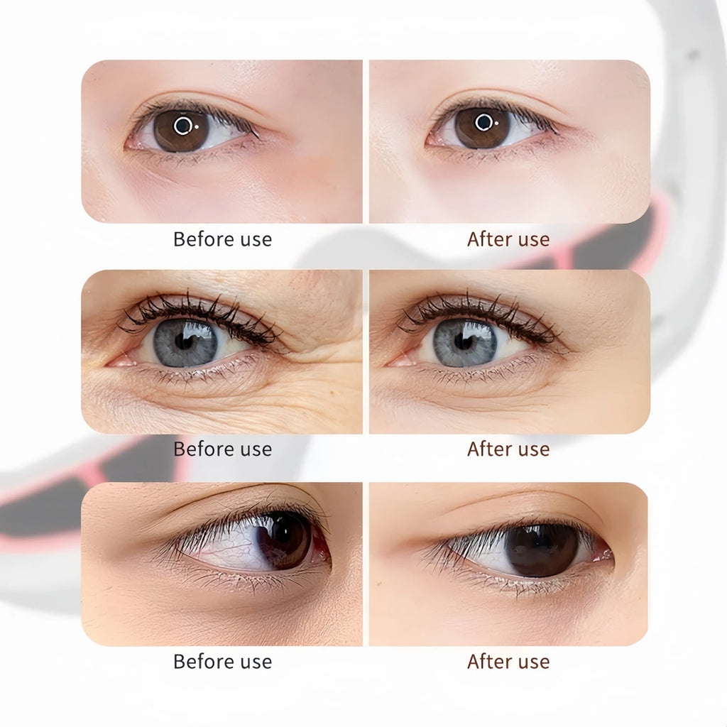 Red Light Eye Massager