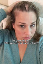 Red Light Therapy for Hair Fast Growth Cap