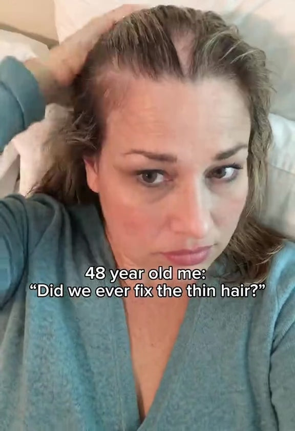 Red Light Therapy for Hair Fast Growth Cap