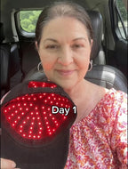Red Light Therapy for Hair Fast Growth Cap