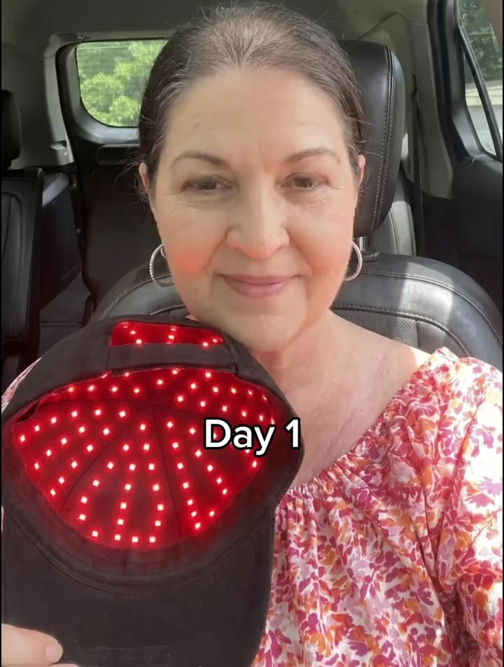 Red Light Therapy for Hair Fast Growth Cap